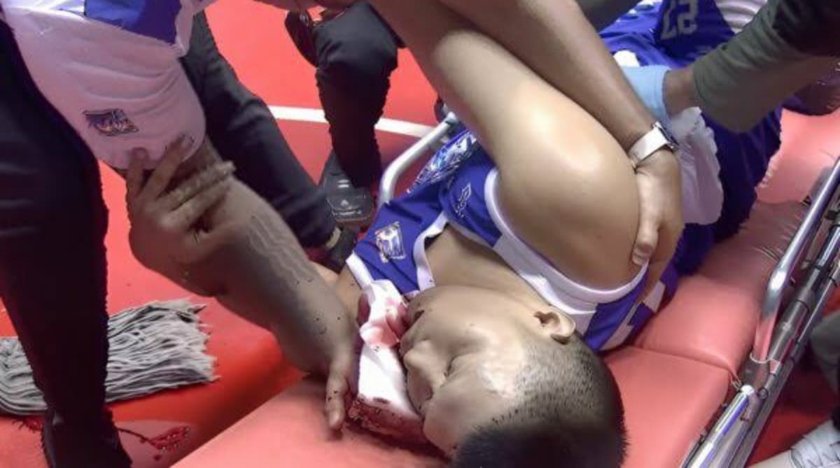 Jonas Tibayan sugatan matapos masuntok ni Michole Sorela sa MPBL Game