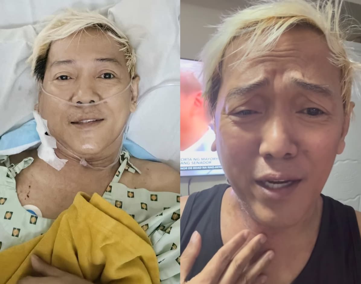 Ate Gay, umani ng pag-asa — lumiit ang bukol sa leeg matapos magsimula ng radiation