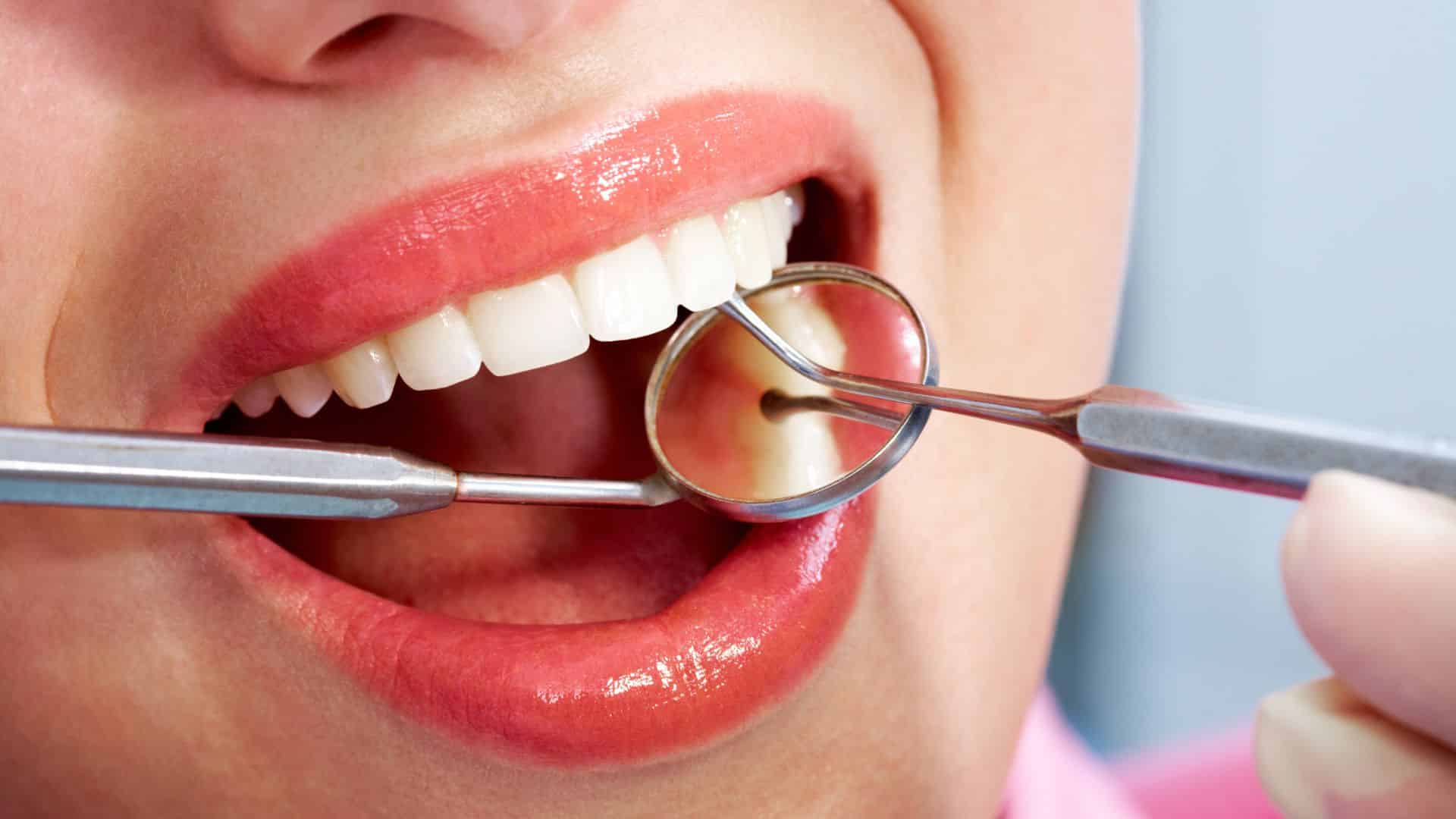 One dentist for every 53,000 Filipinos? — How long can the country ignore its oral health crisis?