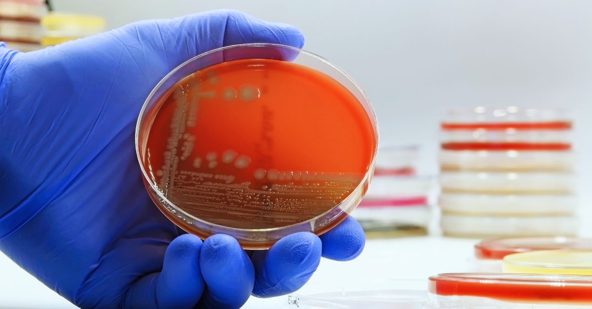 Tubig sa ilang poso sa Los Baños kontaminado ng E. coli — pag-aaral ng UPLB