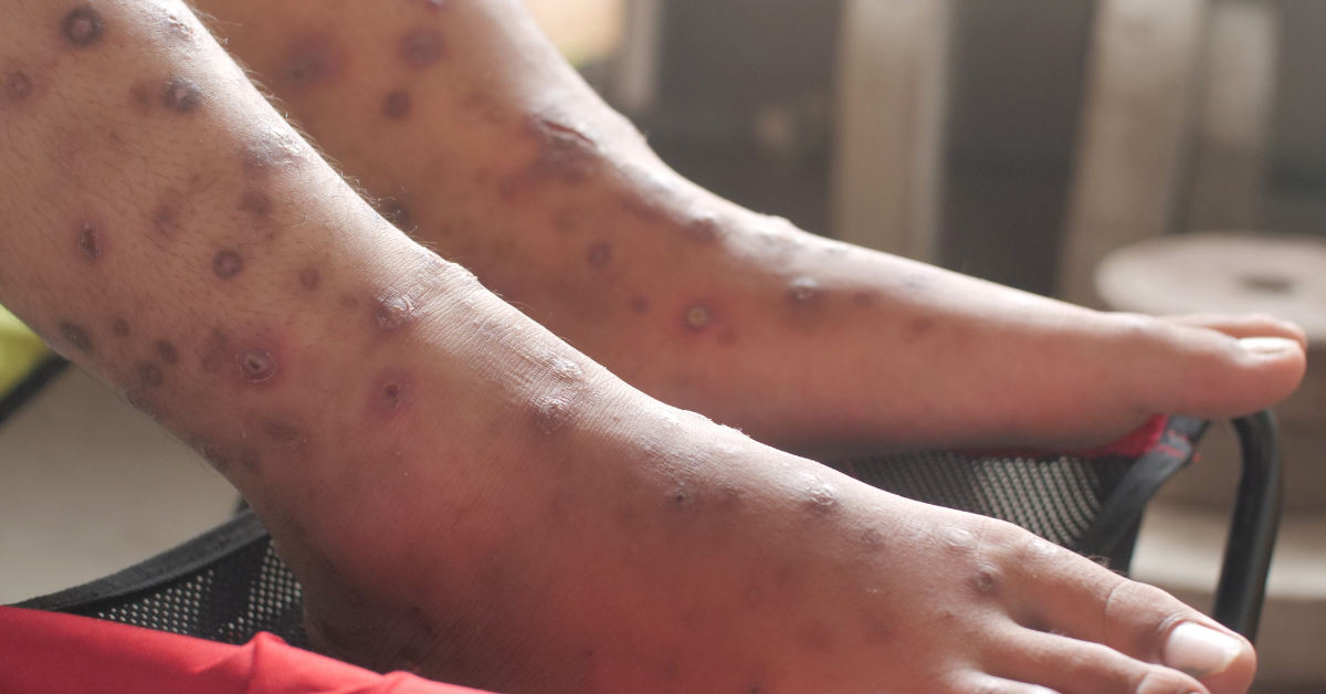 BuCor says no ‘galis’ outbreak among inmates at New Bilibid Prison