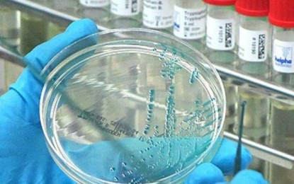 Bagong Strain ng Bird Flu (H5N9) sa Pilipinas: Paano ito nakakaapekto sa mga tao?