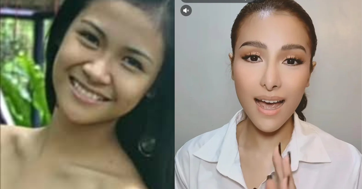 Tabingi daw? Bagong ilong ni Sanya Lopez pinagpyestahan ng netizens